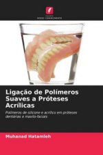 Ligacao de Polimeros Suaves a Proteses Acrilicas