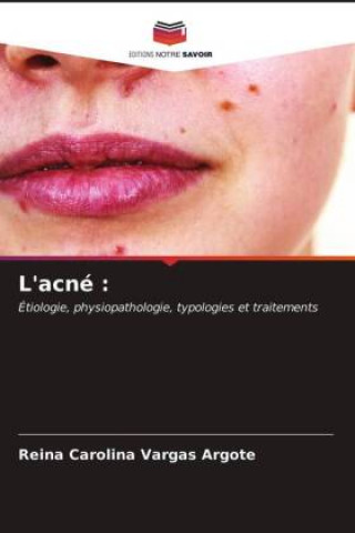 L'acne