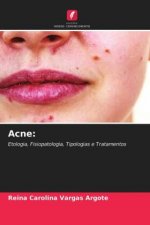 Acne