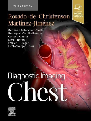 Diagnostic Imaging: Chest (Melissa L. Rosado-de-Christenson,Santiago Martínez-Jiménez)(Kemény kötésű)
