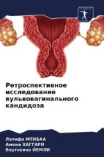 Ретроспективное исслед&#