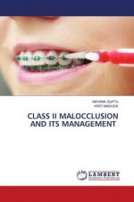 Class II Malocclusion and Its Management