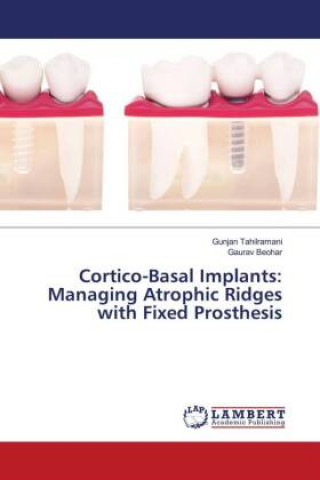 Cortico-Basal Implants