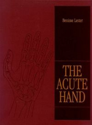 ACUTE HAND