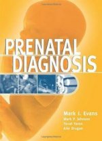 PRENATAL DIAGNOSIS