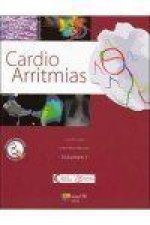 Cardio Arritmias