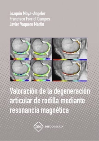 USO DE ANTIFIBRINOLITICOS PARA LA REDUCCION DE PERDIDA SANGUINEA EN CIRUGIA ORTOPEDICA MAYOR