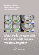 VALORACION DE LA DEGENERACION ARTICULAR DE RODILLA MEDIANTE RESONANCIA MAGNETICA