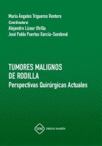 TUMORES MALIGNOS DE RODILLA. PERSPECTIVAS QUIRURGICAS ACTUALES