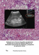 Validación de la técnica ecográfica de radiación acústica de la fuerza de impulso (ARFI) en un biomo
