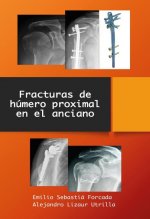 FRACTURAS DE HUMERO PROXIMAL EN EL ANCIANO