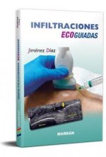 INFILTRACIONES ECOGUIADAS