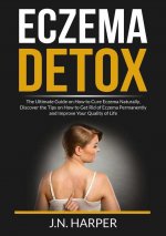 Eczema Detox