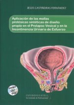 Aplicación de las mallas protésicas sintéticas de diseño propio en el Prolapso Vesical y en la incon