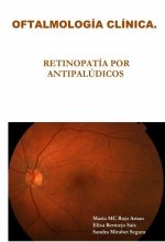 OFTALMOLOGÍA CLÍNICA. RETINOPATÍA POR ANTIPALÚDICOS.
