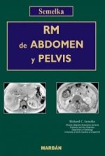 RM DE ABDOMEN Y PELVIS 2VOLS.