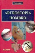 ARTROSCOPIA DE HOMBRO