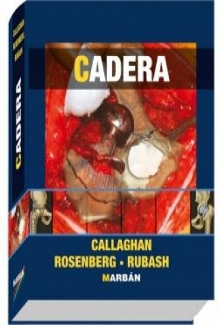 Cadera