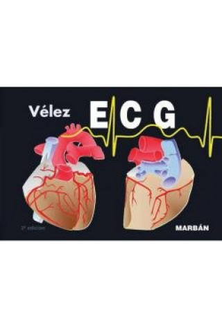 ECG