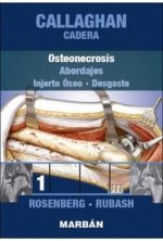 CADERA TOMO 1: OSTEONECROSIS, INJERTO ÓSEO, DESGASTE