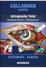 CADERA: ARTROPLASTIA TOTAL: COMPLICACIONES Y ALTERNATIVAS