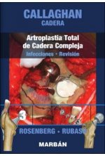 CADERA: ARTROPLASTIA TOTAL DE CADERA COMPLEJA: INFECCIONES - REVISION