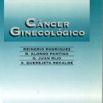 Cáncer de mama