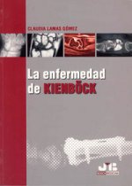 La enfermedad de Kienböck.