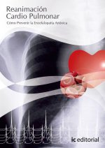 Reanimación cardiopulmonar