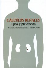 Cálculos renales