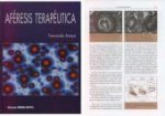 Aféresis terapeutica