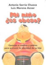 MI NIÑO ES OBESO