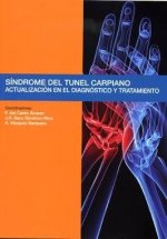 S­ndrome del túnel carpiano