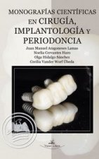 Monograf­as cient­ficas en cirug­a, implantolog­a y periodoncia