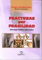 Fracturas por fragilidad