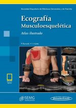 SEMG:EcografÆa MusculoesquelÄtica+e