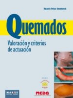 Quemados. Valoración y criterios de actuación