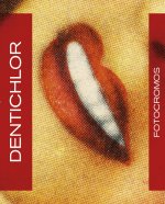 Fotocromos Dentichlor