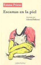 Escamas en la piel