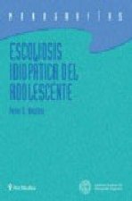 ESCOLIOSIS IDIOPATICA DEL ADOLESCENTE