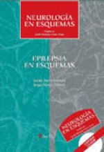Epilepsia en esquemas