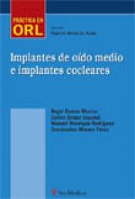 Implantes de o­do medio e implantes cocleares