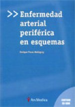 ENFERMEDAD ARTERIAL PERIFéRICA EN ESQUEMAS
