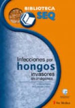 Infecciones por hongos invasores en imágenes