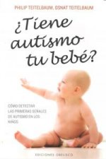 ¿Tiene autismo tu bebé?