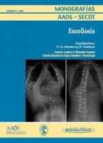 Monograf­a Nº 1/2007: Escoliosis