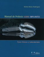 Manual de Prótesis sobre Implantes