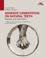 Adhesive cementation on natural teeth - Materials and techniques