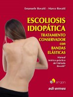 ESCOLIOSIS IDIOPATICA