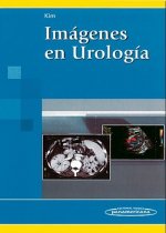 Imágenes en Urolog­a